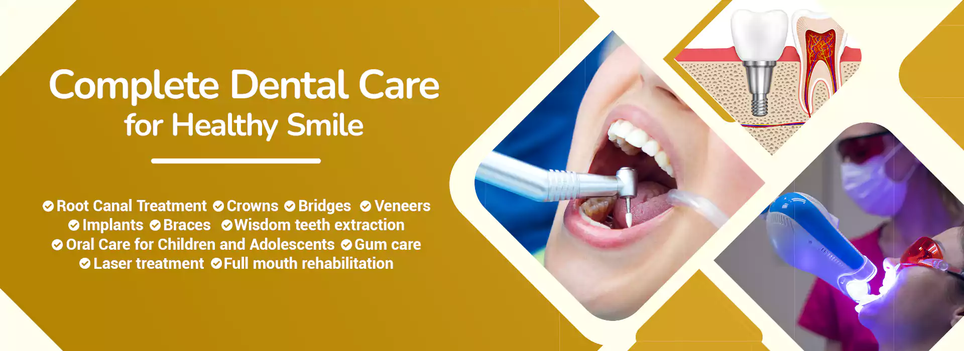  Smile Dental Care, JP Nagar, Bengaluru 